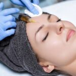 Infiltración intradérmica (mesoterapia)